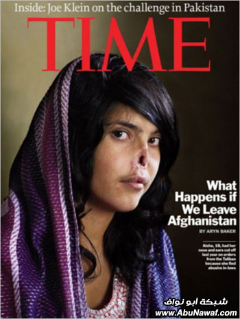 مجدوعة الأنف الأفغانية